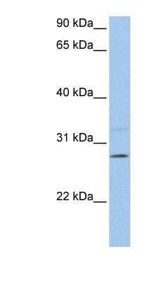 Western Blot: PEMT Antibody [NBP1-59580]