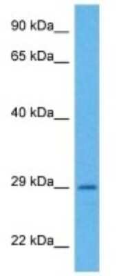 Western Blot: PEMT Antibody [NBP3-11004]