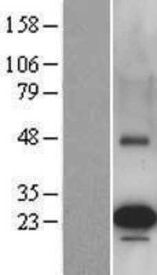 Western Blot: PEMT Overexpression Lysate [NBL1-14286]