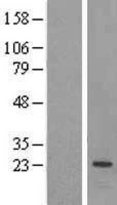 Western Blot: PEMT Overexpression Lysate [NBL1-14288]