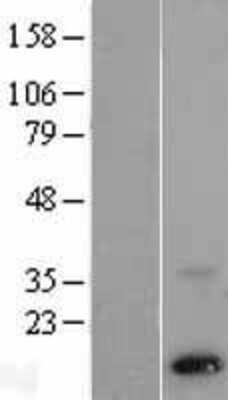 Western Blot: PSENEN/PEN2 Overexpression Lysate [NBL1-14862]