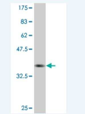 Western Blot: PEO1 Antibody (1C5) [H00056652-M03]