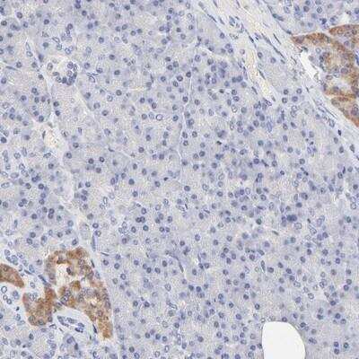 Immunohistochemistry: PEO1 Antibody [NBP1-90814]