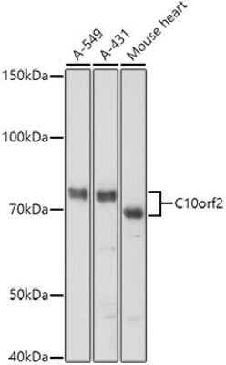 Western Blot: PEO1 AntibodyAzide and BSA Free [NBP2-93513]