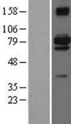 Western Blot: PEO1 Overexpression Lysate [NBL1-08075]