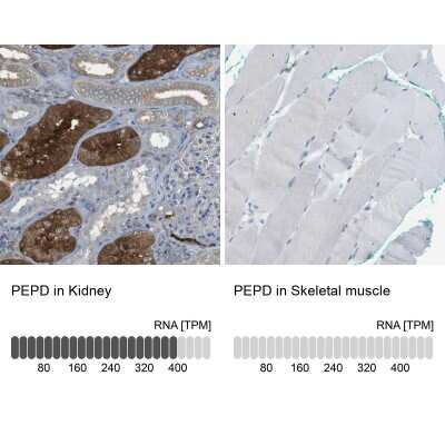 Immunohistochemistry-Paraffin: PEPD Antibody [NBP1-86072]