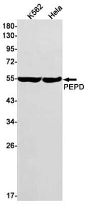 Western Blot: PEPD Antibody (S03-7E5) [NBP3-15074]