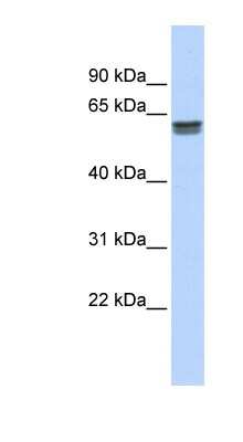 Western Blot: PEPD Antibody [NBP1-56815]