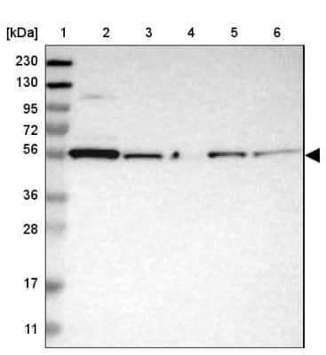 Western Blot: PEPD Antibody [NBP1-86072]