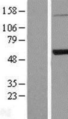 Western Blot: PEPD Overexpression Lysate [NBL1-14290]