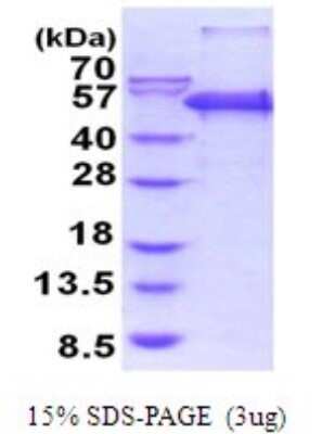 SDS-PAGE: Recombinant Human PEPD His Protein [NBP2-51987]