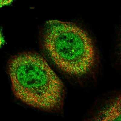 Immunocytochemistry/ Immunofluorescence: PEPP2 Antibody [NBP2-58961]