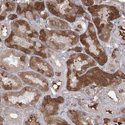 Immunohistochemistry-Paraffin: PEPP2 Antibody [NBP1-84611]