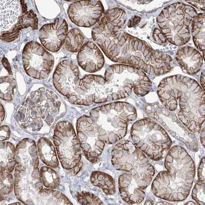 Immunohistochemistry-Paraffin: PEPP2 Antibody [NBP1-84612]