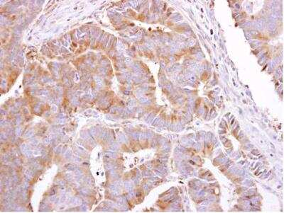 Immunohistochemistry-Paraffin: PEPP2 Antibody [NBP2-19770]