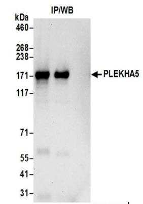 Immunoprecipitation: PEPP2 Antibody [NBP2-37695]