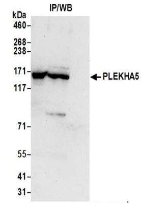 Immunoprecipitation: PEPP2 Antibody [NBP2-37696]