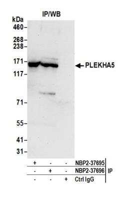 Immunoprecipitation: PEPP2 Antibody [NBP2-37696]