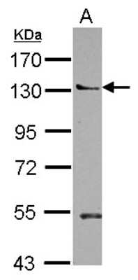 Western Blot: PEPP2 Antibody [NBP2-19770]