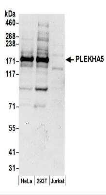 Western Blot: PEPP2 Antibody [NBP2-37696]