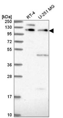 Western Blot: PEPP2 Antibody [NBP2-58961]