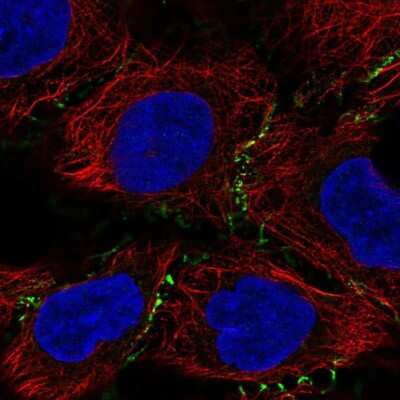 Immunocytochemistry/ Immunofluorescence: PEPP3 Antibody [NBP1-87889]