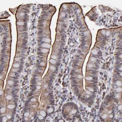 Immunohistochemistry-Paraffin: PEPT1/SLC15A1 Antibody [NBP1-92005]