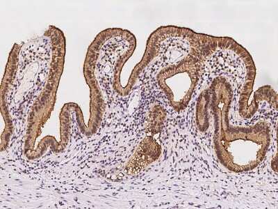 Immunohistochemistry-Paraffin: PEPT1/SLC15A1 Antibody [NBP2-98544]