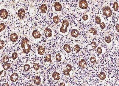 Immunohistochemistry-Paraffin: PEPT1/SLC15A1 Antibody [NBP2-98544]