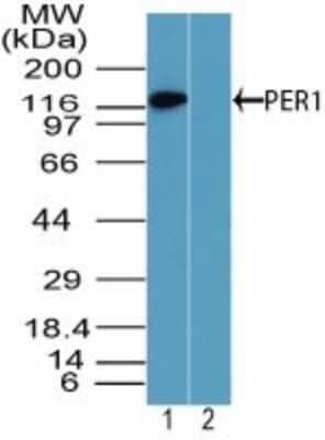 Western Blot: PER1 Antibody [NBP2-24589]