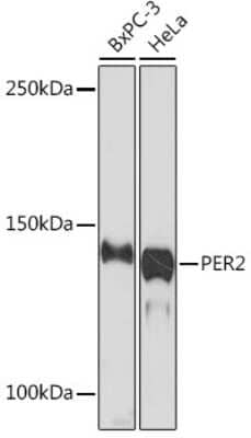 Western Blot: PER2 Antibody (2K9Y0) [NBP3-16557]