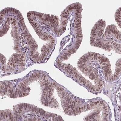 Immunohistochemistry-Paraffin: PER2 Antibody [NBP2-49316]