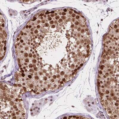 Immunohistochemistry-Paraffin: PER2 Antibody [NBP2-49316]