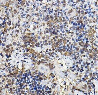 Immunohistochemistry-Paraffin: PER2 Antibody - Azide and BSA Free [NBP2-93587]