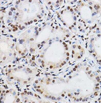 Immunohistochemistry-Paraffin: PER2 Antibody - Azide and BSA Free [NBP2-93587]