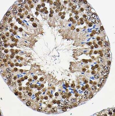 Immunohistochemistry-Paraffin: PER2 Antibody - Azide and BSA Free [NBP2-93587]