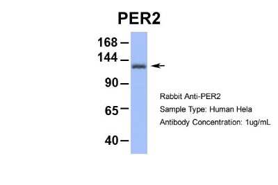 Western Blot: PER2 Antibody [NBP2-88036]