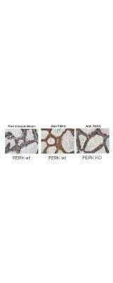 Immunohistochemistry: PERK Antibody [NBP1-78017]