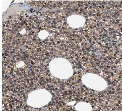 Immunohistochemistry-Paraffin: PERK Antibody [NBP1-80930]