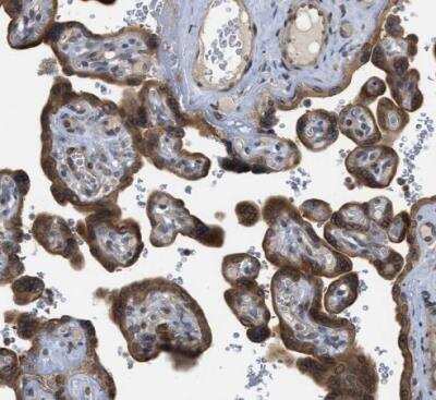 Immunohistochemistry-Paraffin: PERK Antibody [NBP1-80930]
