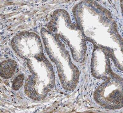 Immunohistochemistry-Paraffin: PERK Antibody [NBP1-80930]