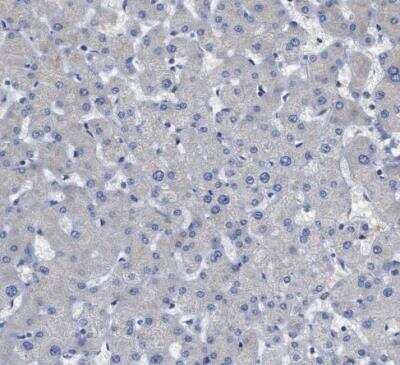 Immunohistochemistry-Paraffin: PERK Antibody [NBP1-80930]