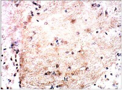 Immunohistochemistry-Paraffin: PERK Antibody [NBP3-12193]