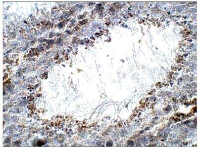 Immunohistochemistry-Paraffin: PERK Antibody [NBP3-12194]