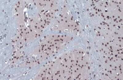 Immunohistochemistry-Paraffin: PERK Antibody [NBP3-12891]