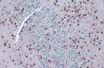 Immunohistochemistry-Paraffin: PERK Antibody [NBP3-12891]