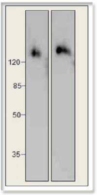 Western Blot: PERK Antibody [NBP3-12193]