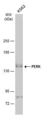 Western Blot: PERK Antibody [NBP3-12891]