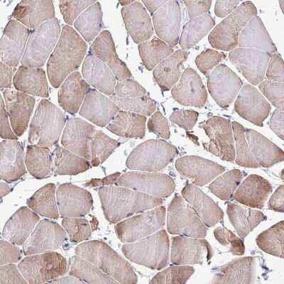Immunohistochemistry-Paraffin: PERM1 Antibody [NBP1-93520]