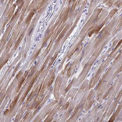 Immunohistochemistry-Paraffin: PERM1 Antibody [NBP1-93520]